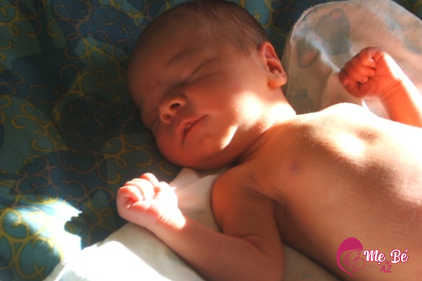 Phơi nắng cho trẻ sơ sinh bị vàng da chỉ áp dụng khi trẻ vàng da sinh lý