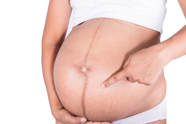 Không nên cạo hoặc triệt lông bụng khi có thai