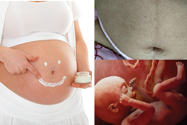 Lông bụng mọc nhiều khi có thai là bình thường hay bất thường?