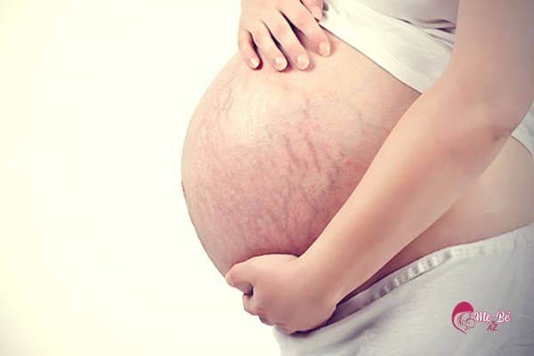 Có thai mấy tháng thì bụng to phụ thuộc vào cơ địa cũng như số lần mang thai của từng mẹ
