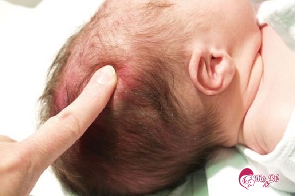 Đầu bé to hay dài cũng có thể là do bệnh lý