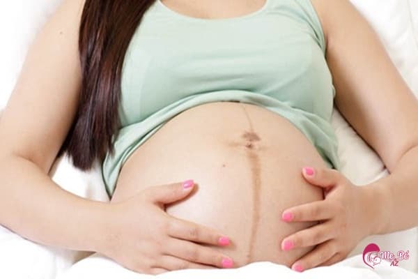  Đường lông ở bụng cũng dự đoán mẹ mang thai con trai hay gái