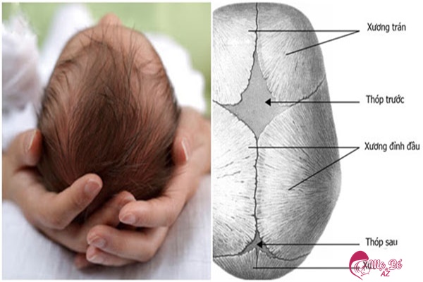 Cấu trúc xương đầu trẻ sơ sinh