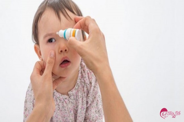 Cách giải quyết khi trẻ 2 tuổi bị đổ ghèn ở mắt?