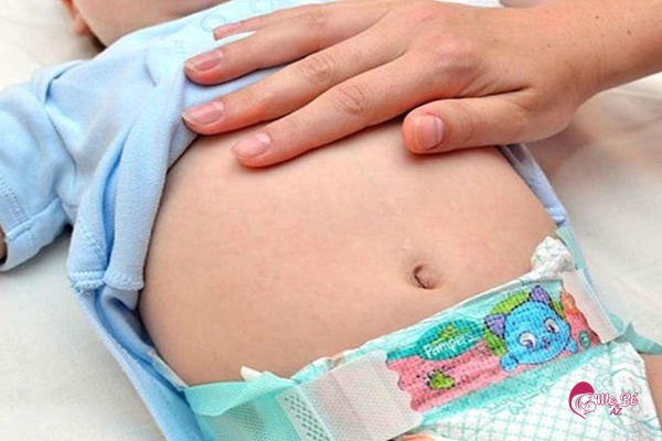 Trẻ sơ sinh bụng to có thể là do bé đang bị đầy hơi, khó tiêu