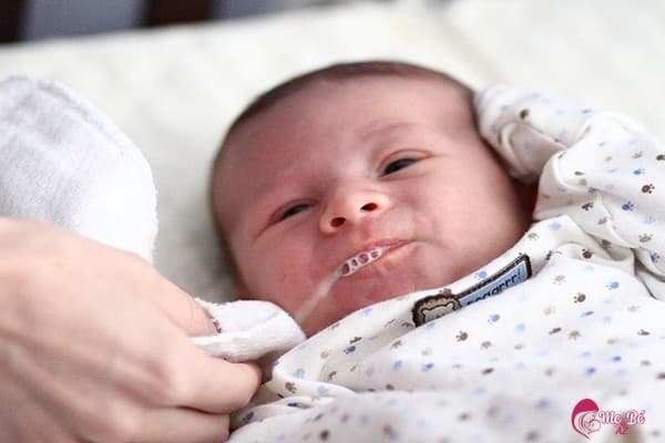 Bị ọc sữa là hiện tượng thường gặp ở trẻ sơ sinh