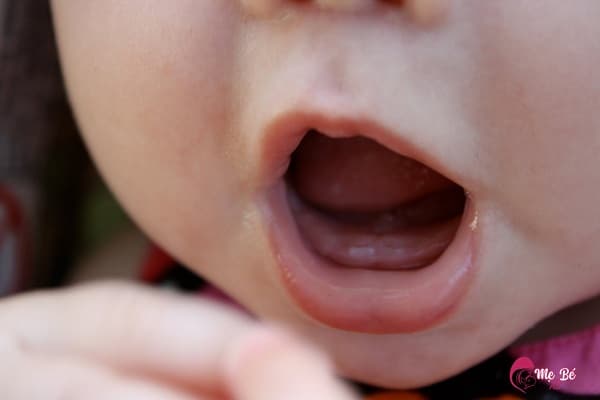 Trẻ sơ sinh mấy tháng thì mọc răng