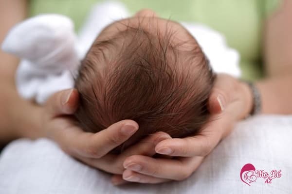 Đầu của trẻ sơ sinh 0 đến 1 tháng tuổi có thể sẽ méo mó